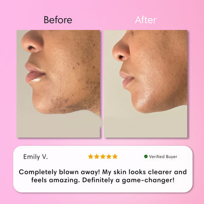 Instant Hair Removal Kit