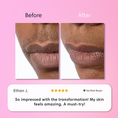 Instant Hair Removal Kit