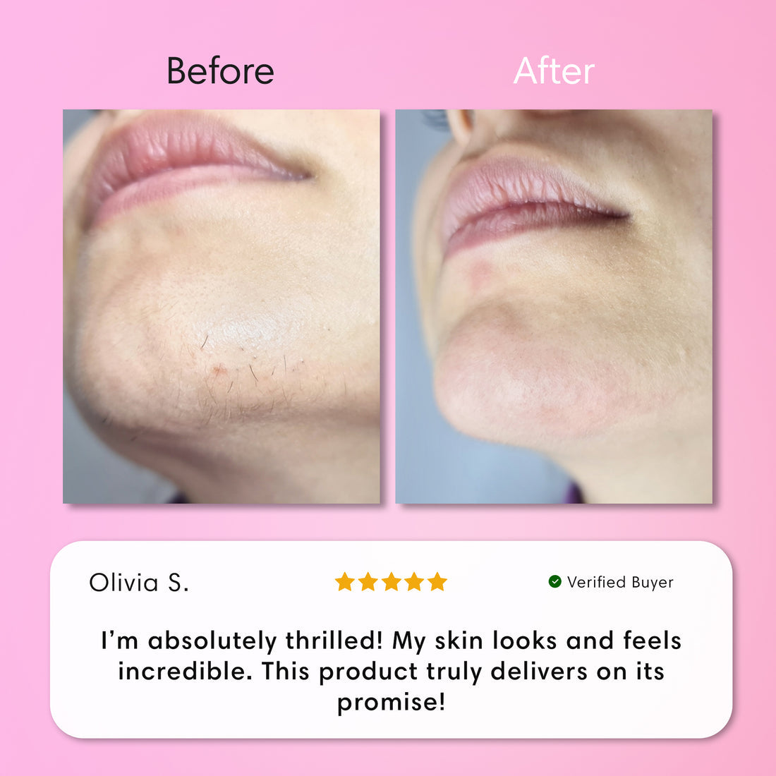 Instant Hair Removal Kit