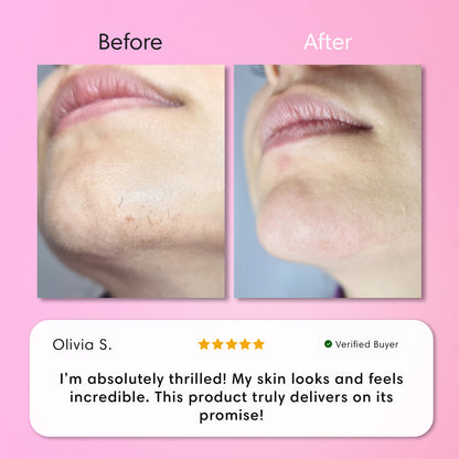 Instant Hair Removal Kit